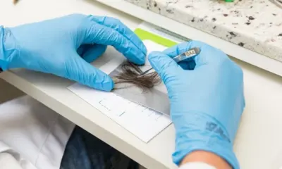 No AC, mulher será indenizada por corte excessivo de cabelo em exame
