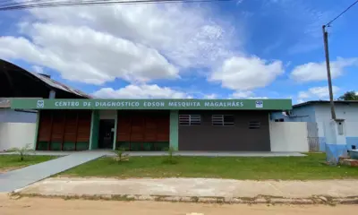 Centro de Diagnóstico terá sistema informatizado para exames em Cruzeiro do Sul
