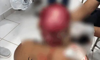 Jovem indígena tem couro cabeludo arrancado ao operar draga no Rio Acre