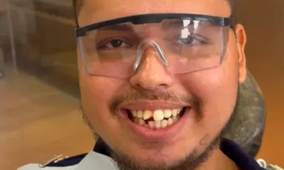 Após acidente, repórter Otávio Damasceno passa por reconstrução dentária para voltar ao trabalho