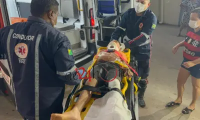 Criança tem perna quebrada ao ser atropelada por moto em Porto Acre