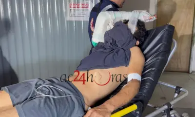 Venezuelano tem casa invadida duas vezes em 48 horas e acaba baleado