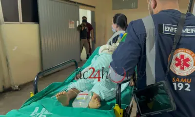 Irmãos sofrem queimaduras após brincadeira com álcool em residência