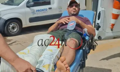 Homem sofre fratura após cair de cavalo na zona rural de Brasiléia