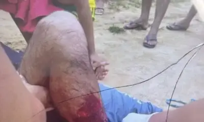 Indígena é ferido por disparo acidental durante caçada em Mâncio Lima