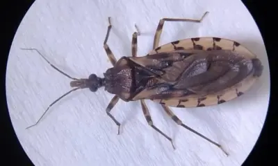 Jovem de 26 anos morre após diagnóstico de doença de Chagas no Pará