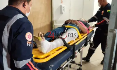 Homem empina moto, colide contra muro e sofre múltiplas fraturas em Rio Branco