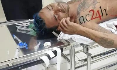 Homem é ferido a golpes de faca e fica com víscera exposta em Sena Madureira