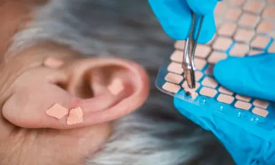 Rio Branco e Cruzeiro do Sul sediam curso nacional de auriculoterapia