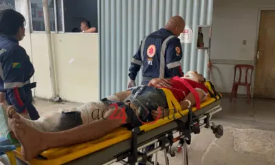 Motociclista sofre fratura exposta após colisão com caçamba na Avenida Jarbas Passarinho