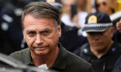 PF diz que foram encontradas alterações neurológicas em exame de Bolsonaro